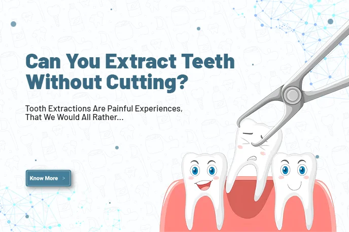 Can you extract teeth without cutting?