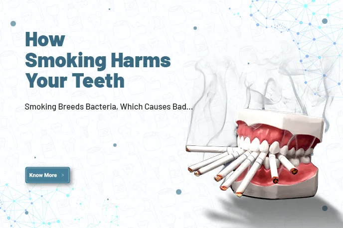 How smoking harms your teeth