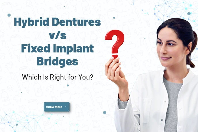 Hybrid Dentures vs. Fixed Implant Bridges