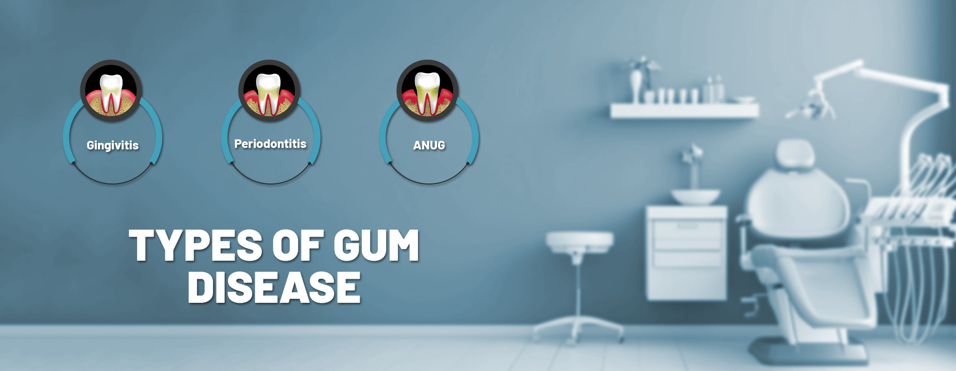 types of gum disease